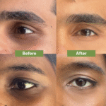 Dark Circle Roll on - Image 3