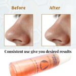 Dual Phase Skin Drink Blackhead Melt - Image 4