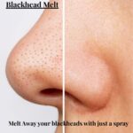 Dual Phase Skin Drink Blackhead Melt - Image 5
