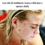 Acne Toner - Image 5