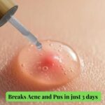 Clear skin Acne Repair Serum - Image 4