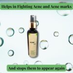 Acne Toner - Image 4